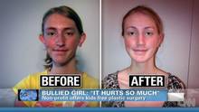 bullied-teen-gets-plastic-sugery-youth-culture