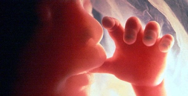 fetus BABY