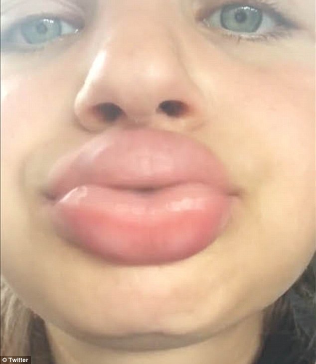 lips shootglass girl