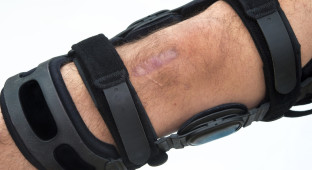 Knee Brace.