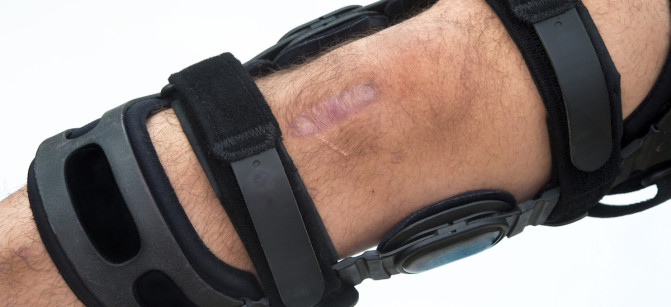 Knee Brace.