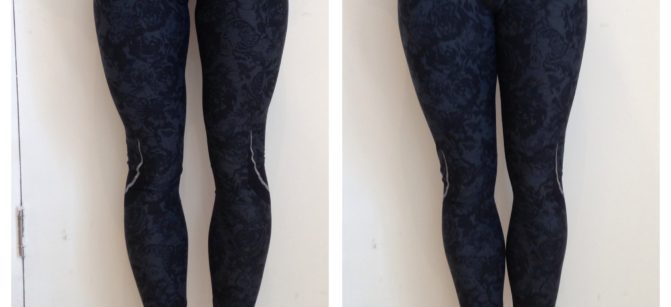 thigh-gap-blog