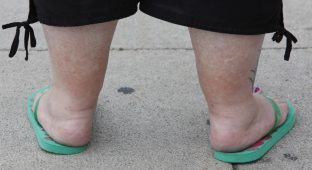 Eine uebergewichtige Frau steht am Mittwoch, 22. Juli 1009, am Alexanderplatz in Berlin. Fettleibigkeit, im Medizinischen Adipositas genannt, gilt als Volkskrankheit. (AP Photo/Franka Bruns)
---An obese woman visits Alexanderplatz in Berlin, Wednesday, July 22, 2009. (AP Photo/Franka Bruns)