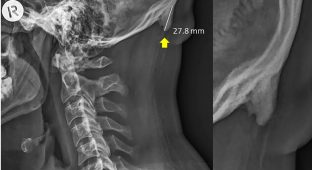 Horn cell