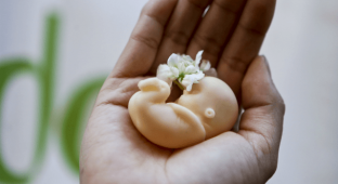 Abortion baby